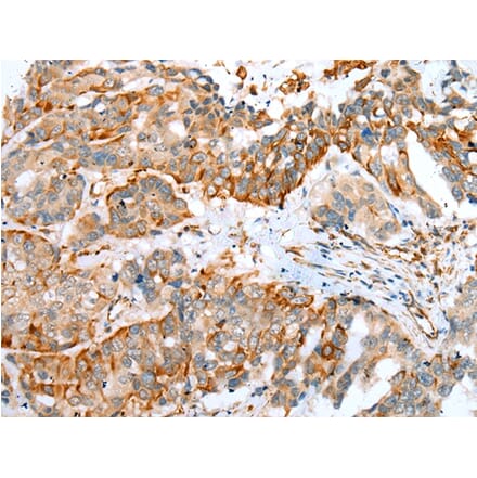 Immunohistochemistry - MYBPHL Antibody from Signalway Antibody (42913) - Antibodies.com