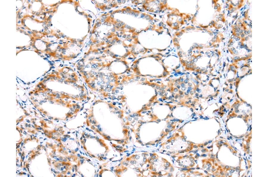 Immunohistochemistry - MYBPHL Antibody from Signalway Antibody (42913) - Antibodies.com