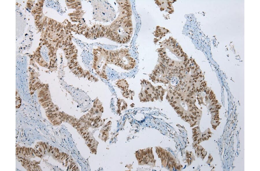 Immunohistochemistry - ZNF486 Antibody from Signalway Antibody (42916) - Antibodies.com