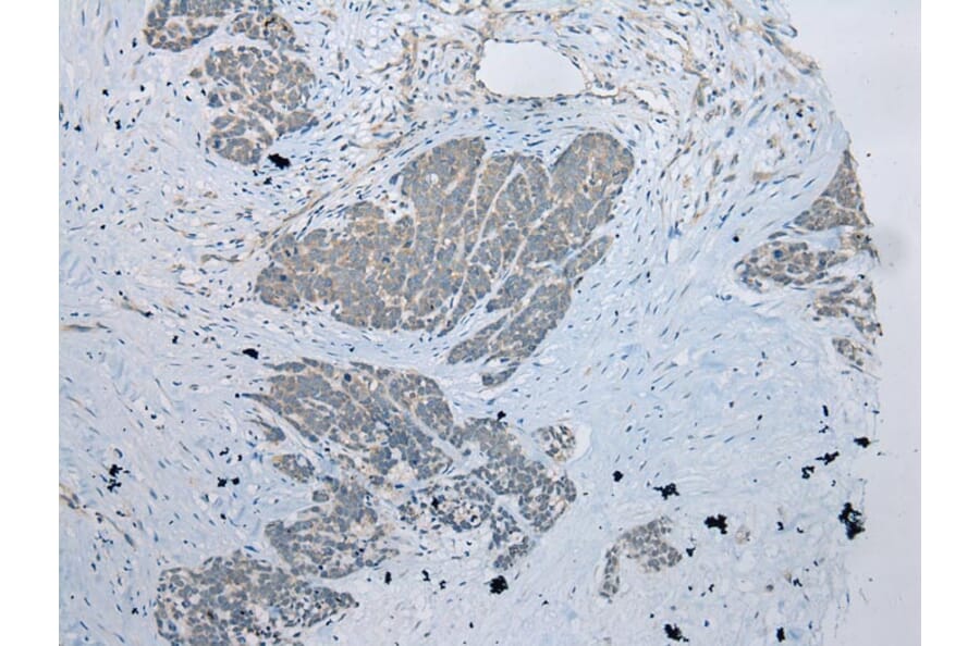 Immunohistochemistry - UBXN2B Antibody from Signalway Antibody (42918) - Antibodies.com