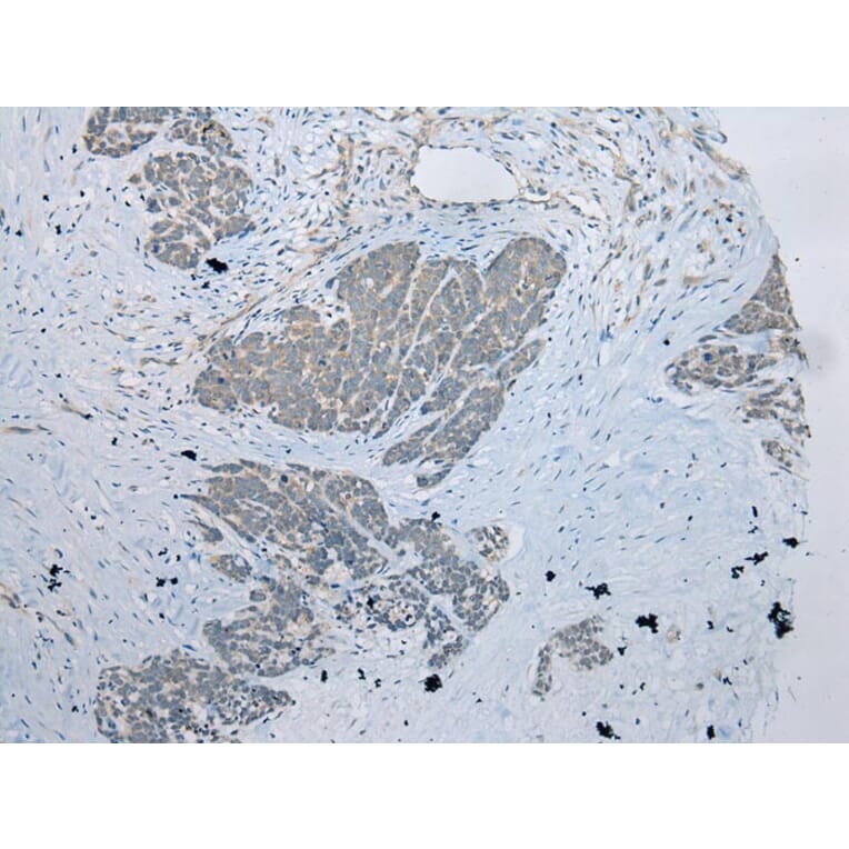 Immunohistochemistry - UBXN2B Antibody from Signalway Antibody (42918) - Antibodies.com