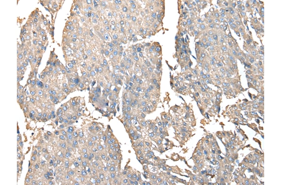 Immunohistochemistry - PRSS38 Antibody from Signalway Antibody (42924) - Antibodies.com