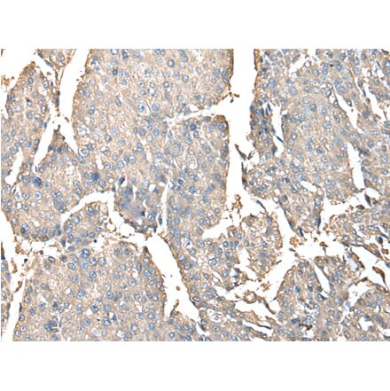 Immunohistochemistry - PRSS38 Antibody from Signalway Antibody (42924) - Antibodies.com