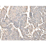 Immunohistochemistry - PRSS38 Antibody from Signalway Antibody (42924) - Antibodies.com