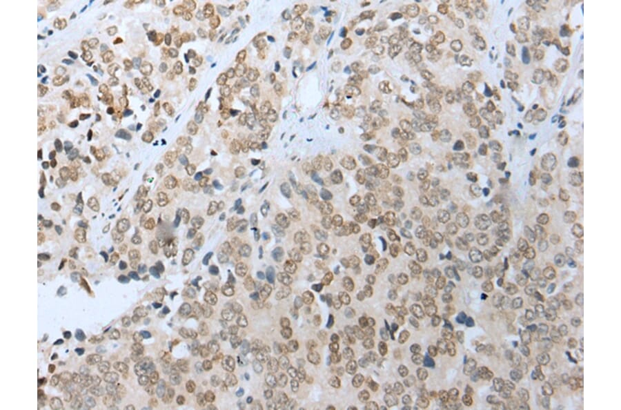 Immunohistochemistry - COMMD6 Antibody from Signalway Antibody (42937) - Antibodies.com