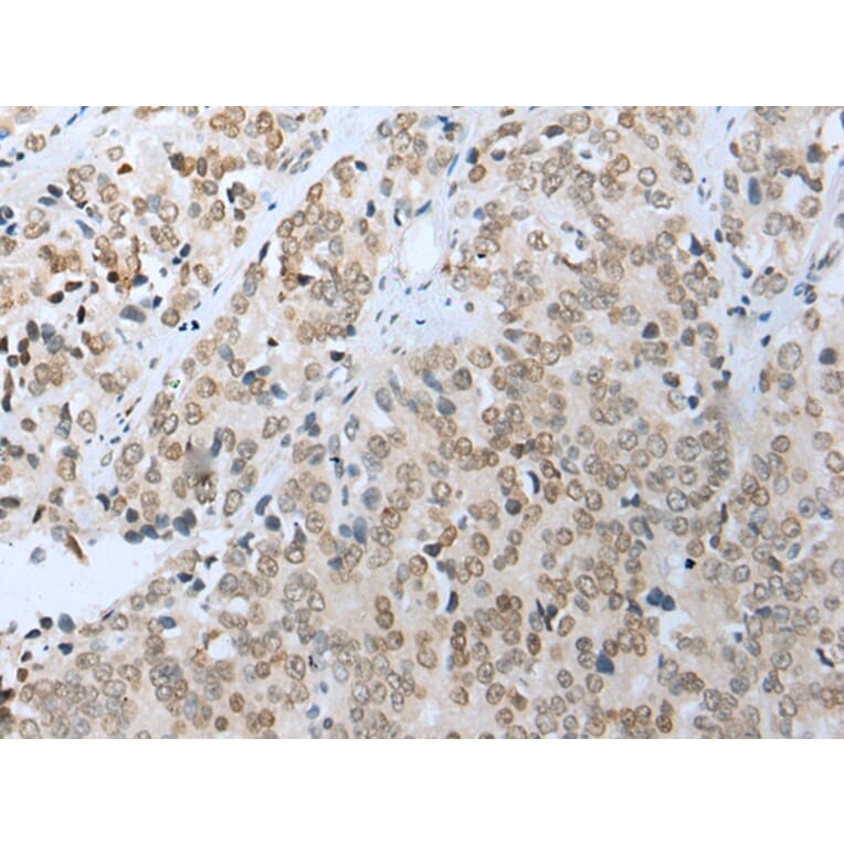 Immunohistochemistry - COMMD6 Antibody from Signalway Antibody (42937) - Antibodies.com