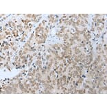 Immunohistochemistry - COMMD6 Antibody from Signalway Antibody (42937) - Antibodies.com