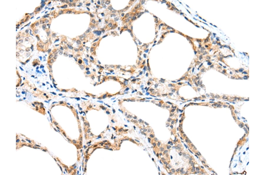 Immunohistochemistry - SPACA3 Antibody from Signalway Antibody (42941) - Antibodies.com