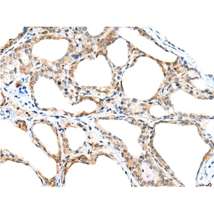 Immunohistochemistry - SPACA3 Antibody from Signalway Antibody (42941) - Antibodies.com