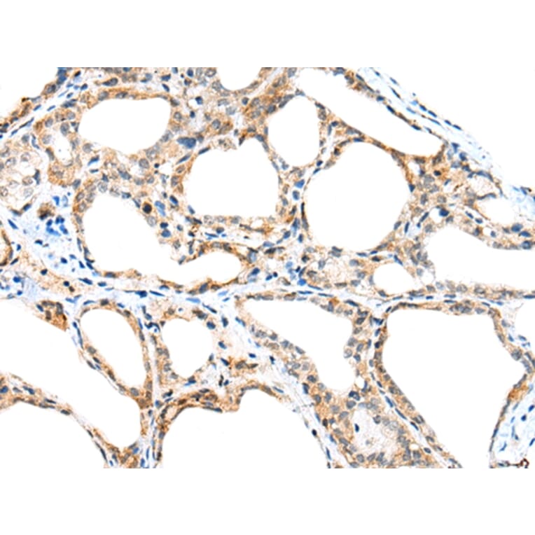 Immunohistochemistry - SPACA3 Antibody from Signalway Antibody (42941) - Antibodies.com