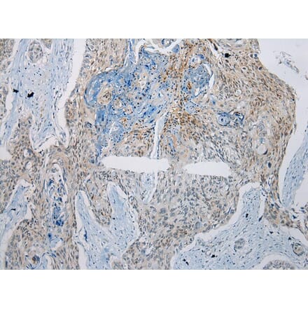Immunohistochemistry - GTF2H2 Antibody from Signalway Antibody (42960) - Antibodies.com