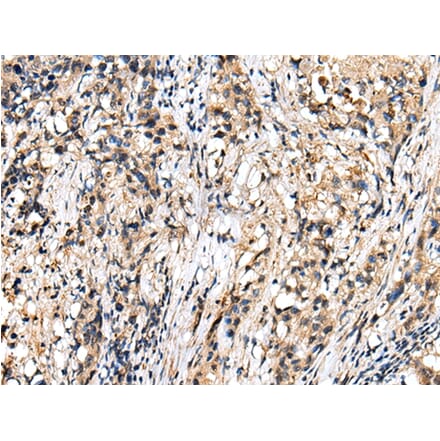 Immunohistochemistry - RHEBL1 Antibody from Signalway Antibody (42968) - Antibodies.com