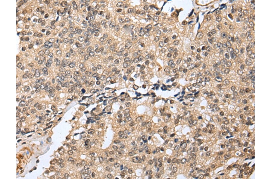 Immunohistochemistry - RHEBL1 Antibody from Signalway Antibody (42968) - Antibodies.com
