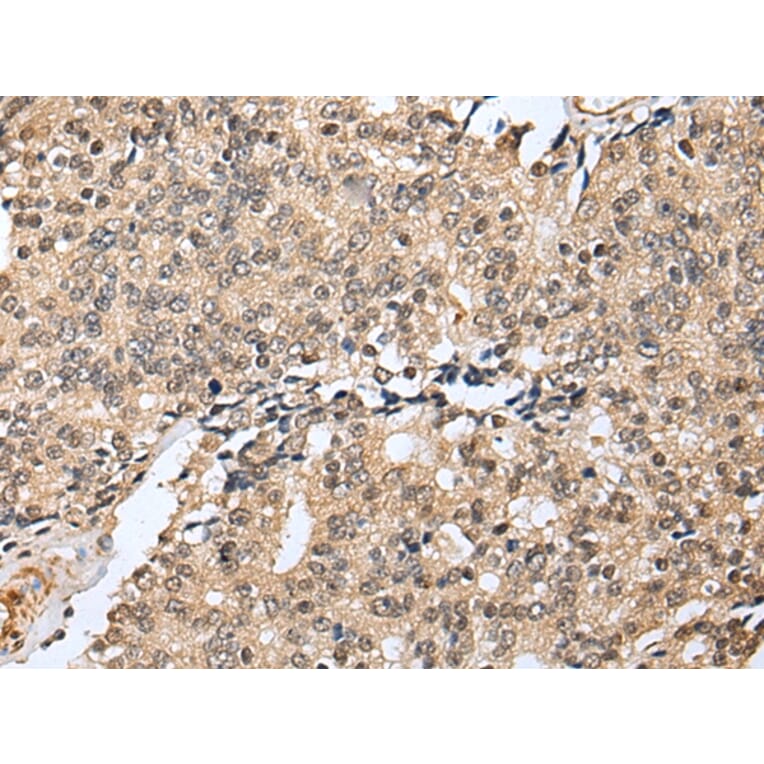 Immunohistochemistry - RHEBL1 Antibody from Signalway Antibody (42968) - Antibodies.com