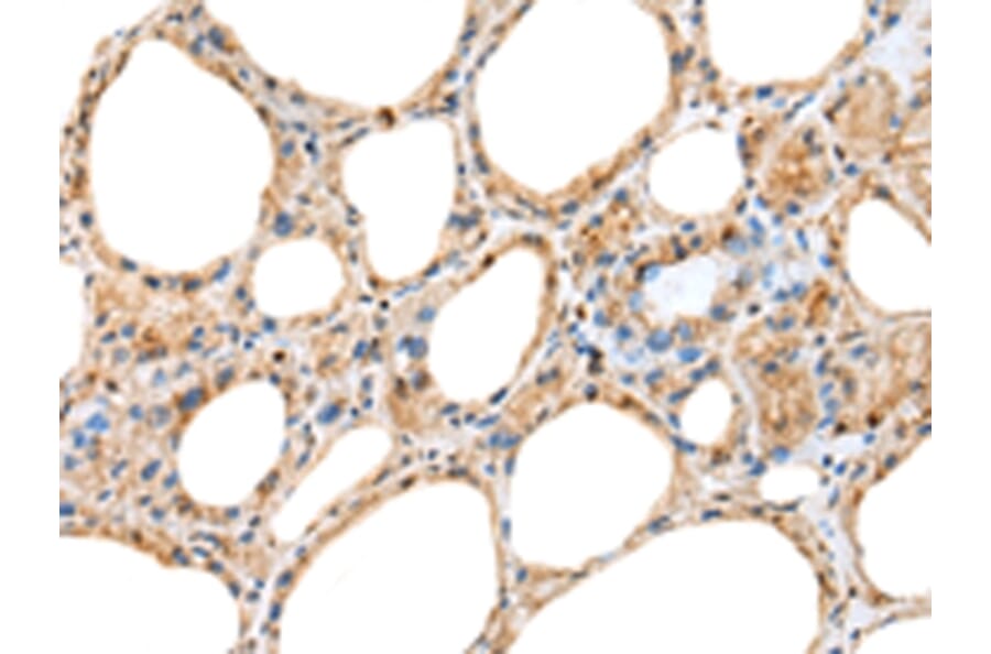 Immunohistochemistry - RAB11A Antibody from Signalway Antibody (42976) - Antibodies.com