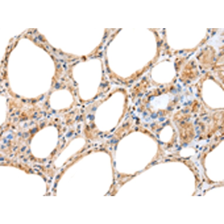 Immunohistochemistry - RAB11A Antibody from Signalway Antibody (42976) - Antibodies.com