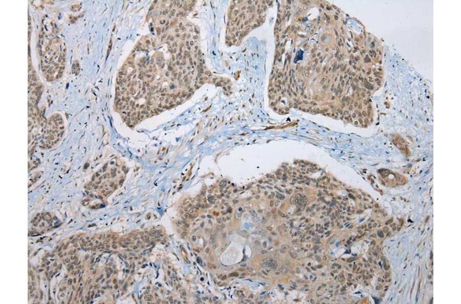 Immunohistochemistry - NUDCD3 Antibody from Signalway Antibody (42980) - Antibodies.com