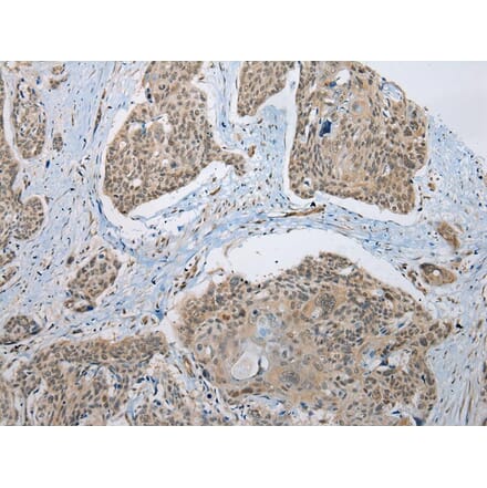 Immunohistochemistry - NUDCD3 Antibody from Signalway Antibody (42980) - Antibodies.com