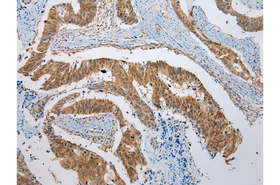 Immunohistochemistry - NUDCD3 Antibody from Signalway Antibody (42980) - Antibodies.com
