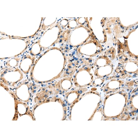 Immunohistochemistry - DNAAF5 Antibody from Signalway Antibody (42981) - Antibodies.com