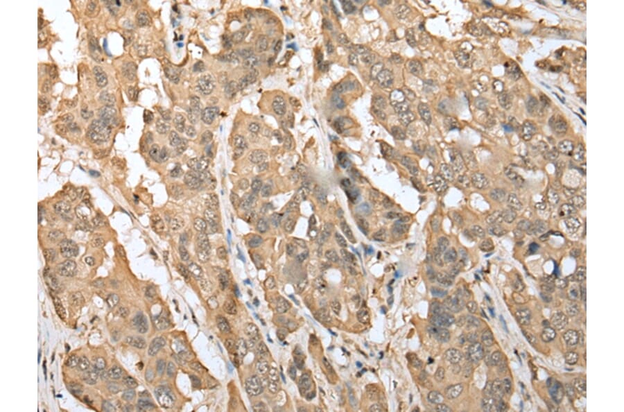Immunohistochemistry - ZNF672 Antibody from Signalway Antibody (42982) - Antibodies.com