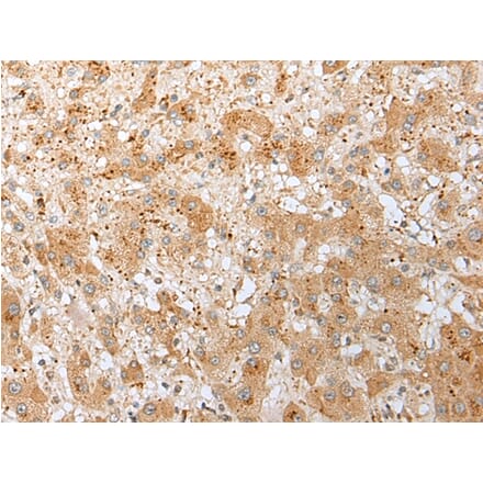 Immunohistochemistry - DNAJB9 Antibody from Signalway Antibody (42984) - Antibodies.com