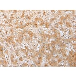 Immunohistochemistry - DNAJB9 Antibody from Signalway Antibody (42984) - Antibodies.com