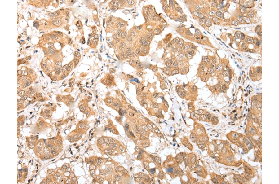 Immunohistochemistry - DNAJB9 Antibody from Signalway Antibody (42984) - Antibodies.com