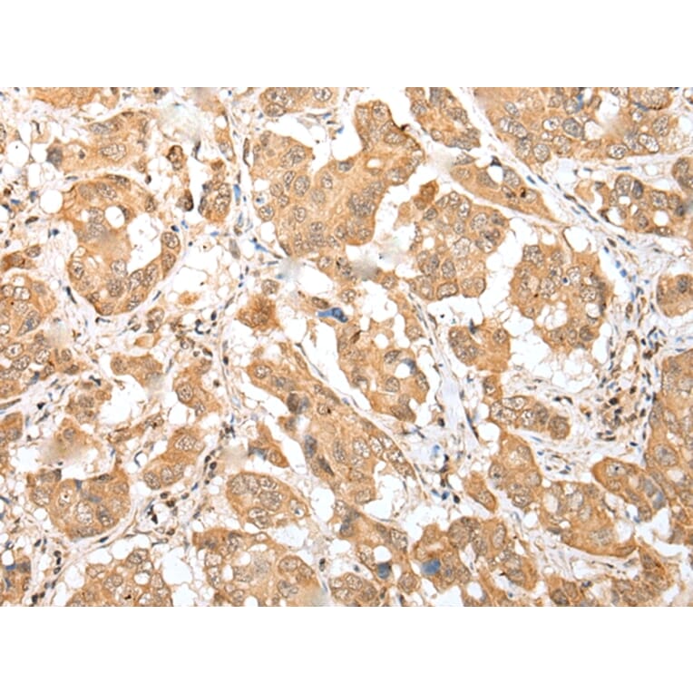 Immunohistochemistry - DNAJB9 Antibody from Signalway Antibody (42984) - Antibodies.com