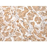 Immunohistochemistry - DNAJB9 Antibody from Signalway Antibody (42984) - Antibodies.com