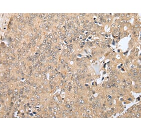 Immunohistochemistry - RNF114 Antibody from Signalway Antibody (42990) - Antibodies.com