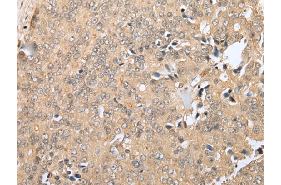 Immunohistochemistry - RNF114 Antibody from Signalway Antibody (42990) - Antibodies.com