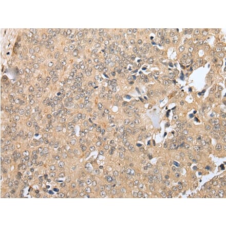 Immunohistochemistry - RNF114 Antibody from Signalway Antibody (42990) - Antibodies.com