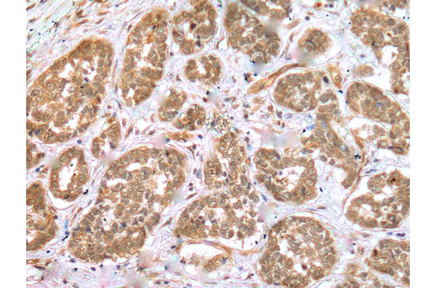 Immunohistochemistry - RNF114 Antibody from Signalway Antibody (42990) - Antibodies.com