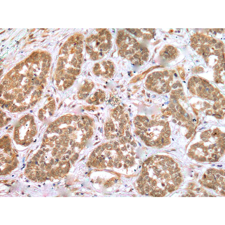 Immunohistochemistry - RNF114 Antibody from Signalway Antibody (42990) - Antibodies.com