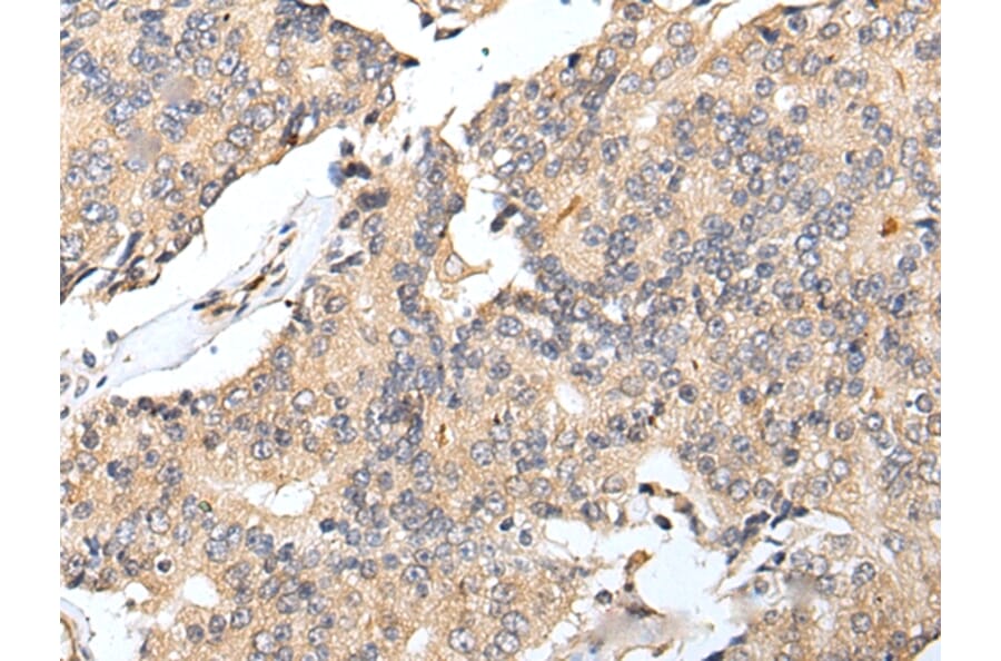 Immunohistochemistry - RNF141 Antibody from Signalway Antibody (42992) - Antibodies.com
