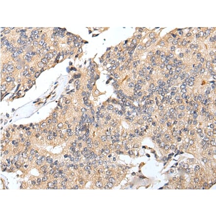 Immunohistochemistry - RNF141 Antibody from Signalway Antibody (42992) - Antibodies.com