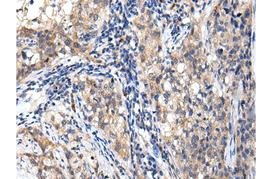 Immunohistochemistry - RNF141 Antibody from Signalway Antibody (42992) - Antibodies.com