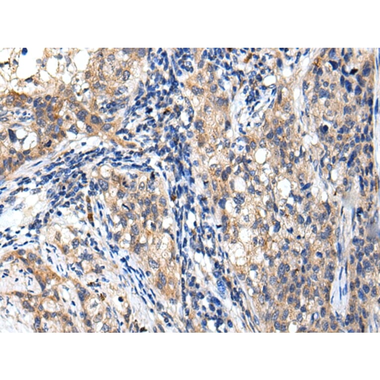 Immunohistochemistry - RNF141 Antibody from Signalway Antibody (42992) - Antibodies.com