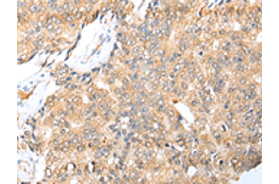 Immunohistochemistry - LYPLA1 Antibody from Signalway Antibody (42993) - Antibodies.com