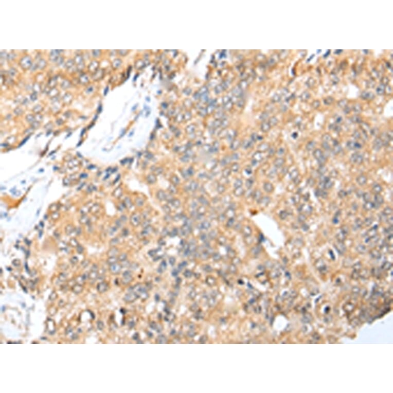Immunohistochemistry - LYPLA1 Antibody from Signalway Antibody (42993) - Antibodies.com