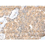 Immunohistochemistry - LYPLA1 Antibody from Signalway Antibody (42993) - Antibodies.com