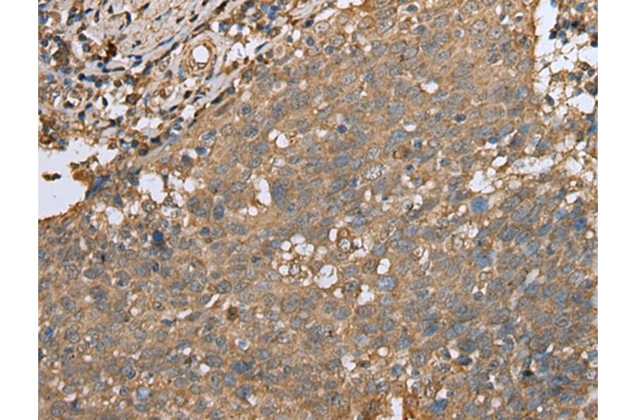 Immunohistochemistry - ALKBH8 Antibody from Signalway Antibody (42995) - Antibodies.com
