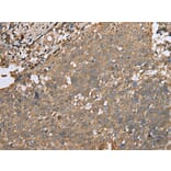 Immunohistochemistry - ALKBH8 Antibody from Signalway Antibody (42995) - Antibodies.com
