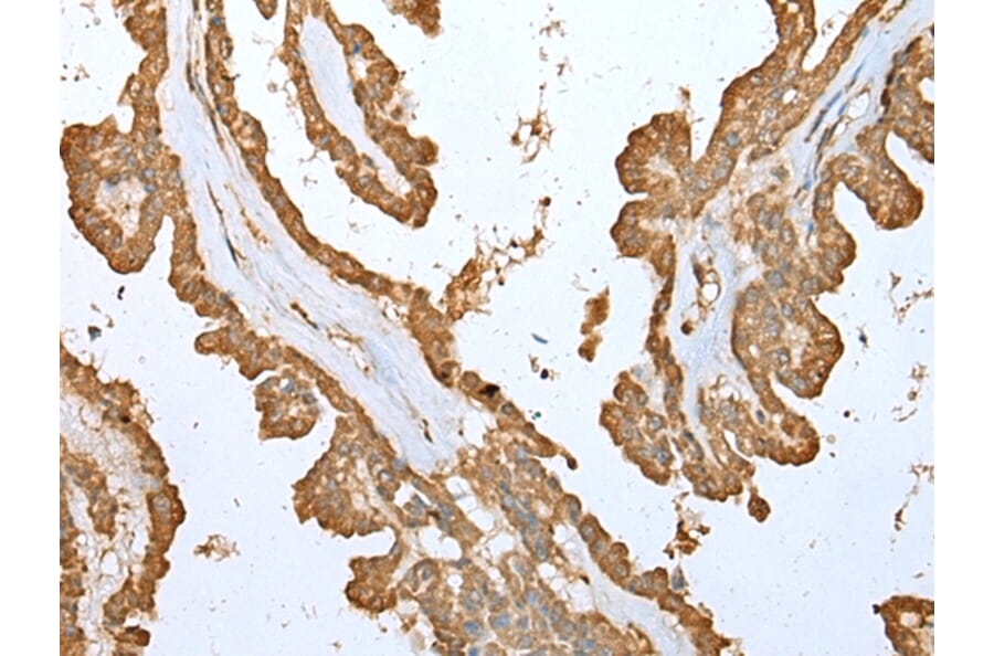 Immunohistochemistry - ALKBH8 Antibody from Signalway Antibody (42995) - Antibodies.com