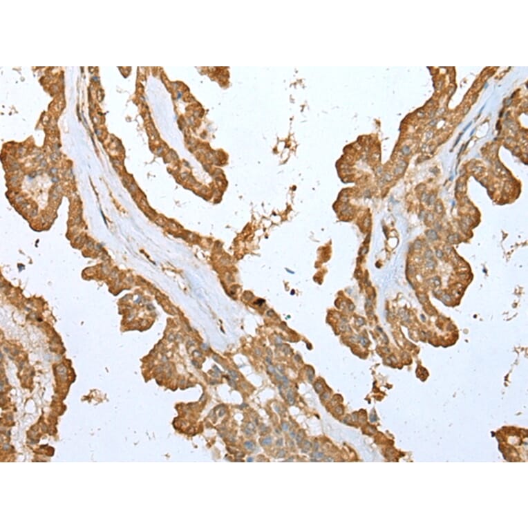 Immunohistochemistry - ALKBH8 Antibody from Signalway Antibody (42995) - Antibodies.com