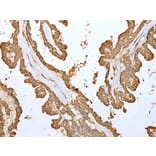 Immunohistochemistry - ALKBH8 Antibody from Signalway Antibody (42995) - Antibodies.com