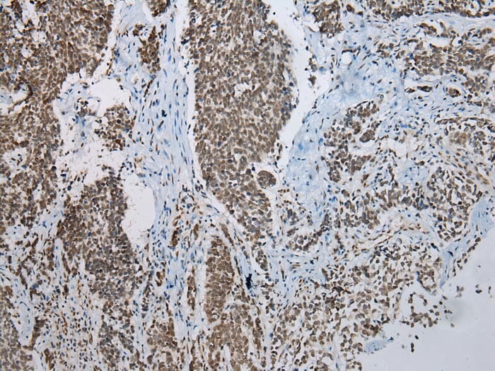 Immunohistochemical analysis of paraffin-embedded Human Lung tissue using #43000 at dilution 1/200.