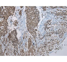 Immunohistochemistry - NSMCE2 Antibody from Signalway Antibody (43000) - Antibodies.com