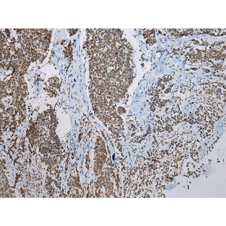 Immunohistochemistry - NSMCE2 Antibody from Signalway Antibody (43000) - Antibodies.com
